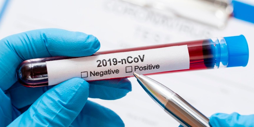 TCU monitora recurso público destinado ao combate à Covid-19 em&nbsp;Macapá